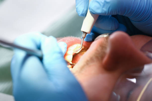 Best Urgent Care for Lost Fillings or Crowns in Pistakee Highlands, IL